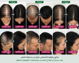 شامبو السدر  2